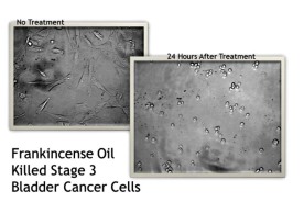 cancer_cells_before_after3